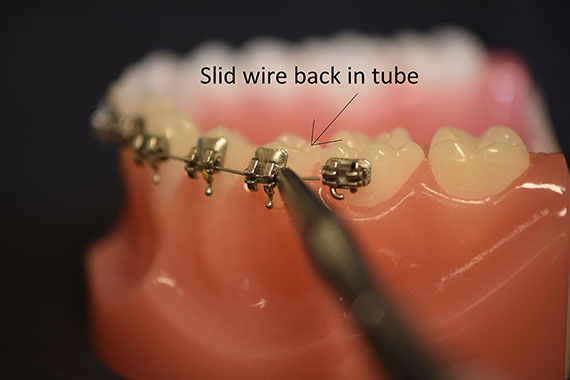Slide Wire Back In Tube