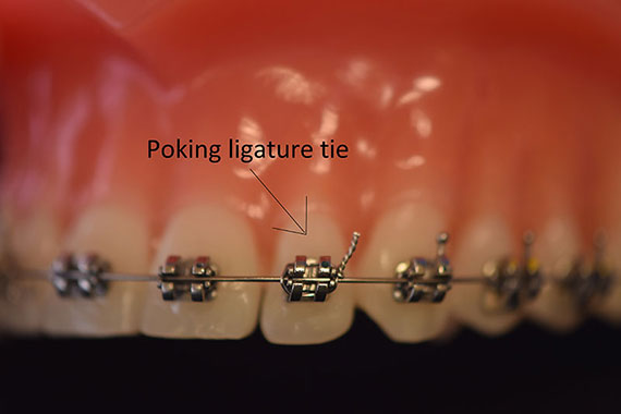 Orthodontic Care From Home