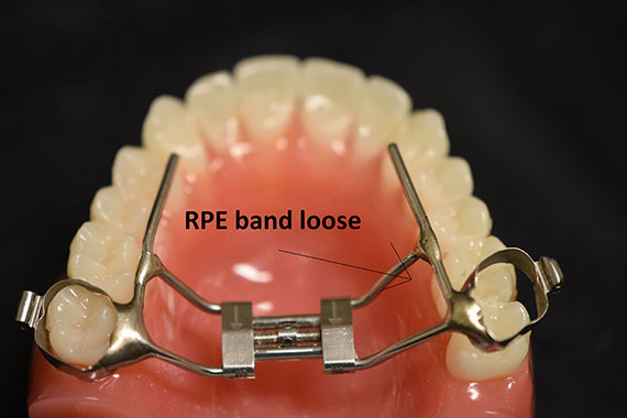 Rapic Palletal Expander Loose