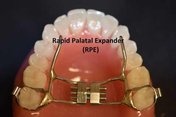 Normal Rapid Palletal Expander