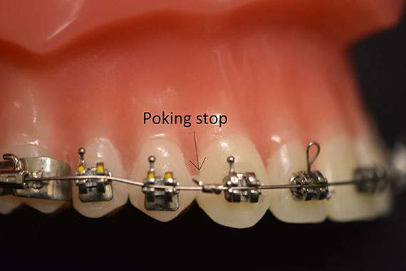 Tooth gum through of poking Bone fragment