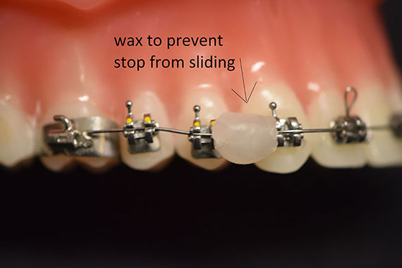 Wax to Prevent Sliding