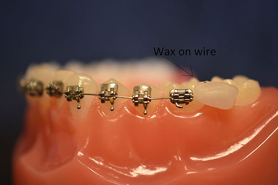 Wax on Wire