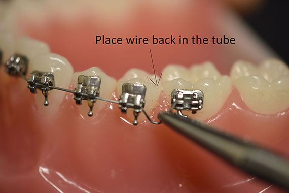 Place wire back in the tube