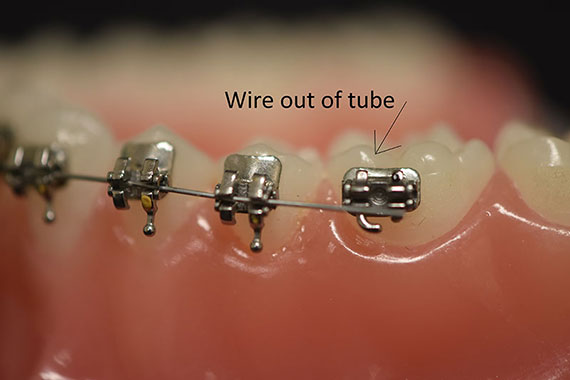 Wire out of tube