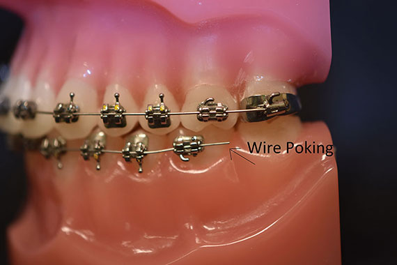 Wire Poking - Too Long